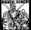 BROKEN BONES / Dem Bones(LP)