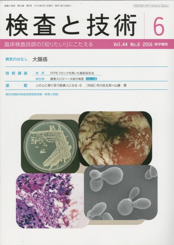 検査と技術　Vol.43　(2015)　No.8　鉄欠乏性貧血