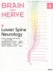 BRAIN and NERVE Vol. 73 No.6 (2021ǯ6)  Lower Spine Neurology