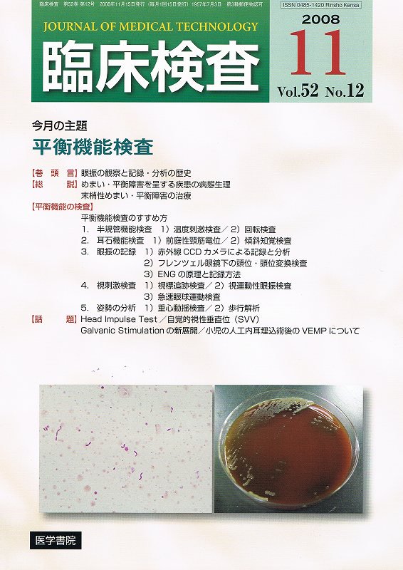臨床検査　Vol.52　東亜ブックWEBショップ　no.12(2008)　平衡機能検査