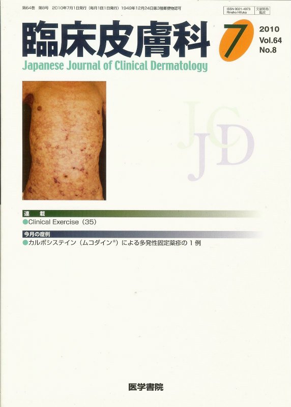 臨床皮膚科　東亜ブックWEBショップ　(2010)　Vol.64　no.8　カルボシステイン(ムコダイン(R))による多発性固定薬疹の1例