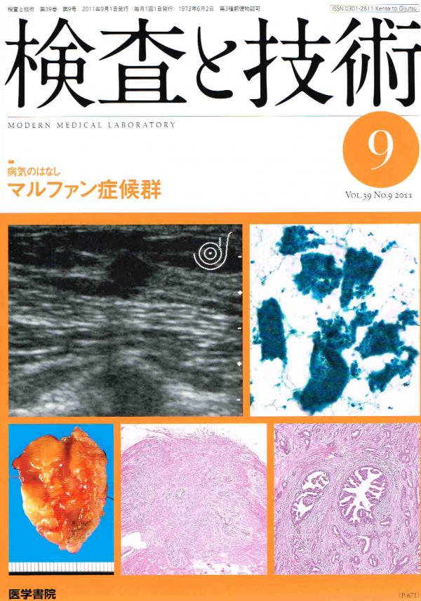 検査と技術　マルファン症候群　Vol.39　no.9(2011)　東亜ブックWEBショップ