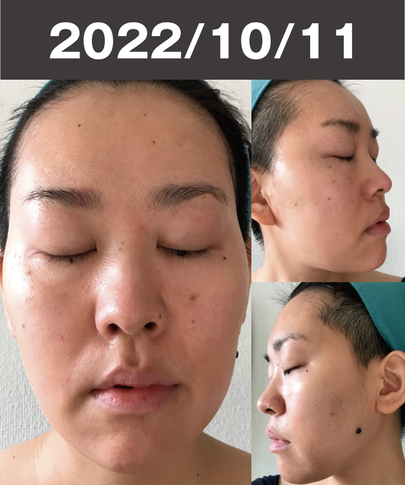 2022/10/11 