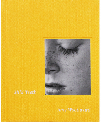 Milk Teeth